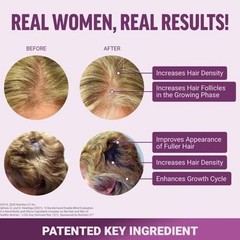 Force Factor Hair Growth Accelerator Soft Chews, Hair Growth Vitamins 4 Women