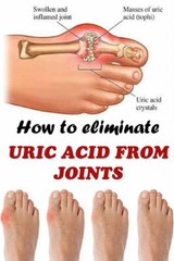 URIC ACID COMPLEX – diuretic ultra – urination health Cranberry 3 Bot