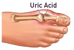 reduce joint inflammation – Uric Acid Formula 1430mg – antioxidant capsules 3B