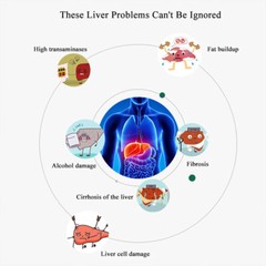 Milk Thistle Liver Detoxification and Cleansing Supplement 300 Mg, 30 To120Caps