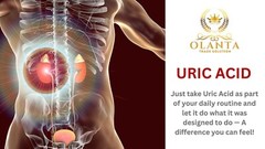 Uric Acid Support Complex Designed for Joints Support, Kidney Support & Immune 1